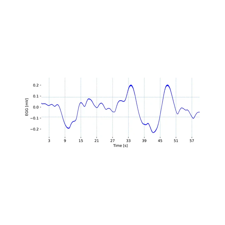 Vista 4 de Sensor de electrogastrografía